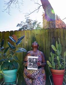 come celebrate with me shows a Black woman gazing beatifically upwards, holding a CT scan of her fibroids. She wears a matching pink leopard print set in front of a planked fence, sun streaming through the trees with potted plants on either side of her.